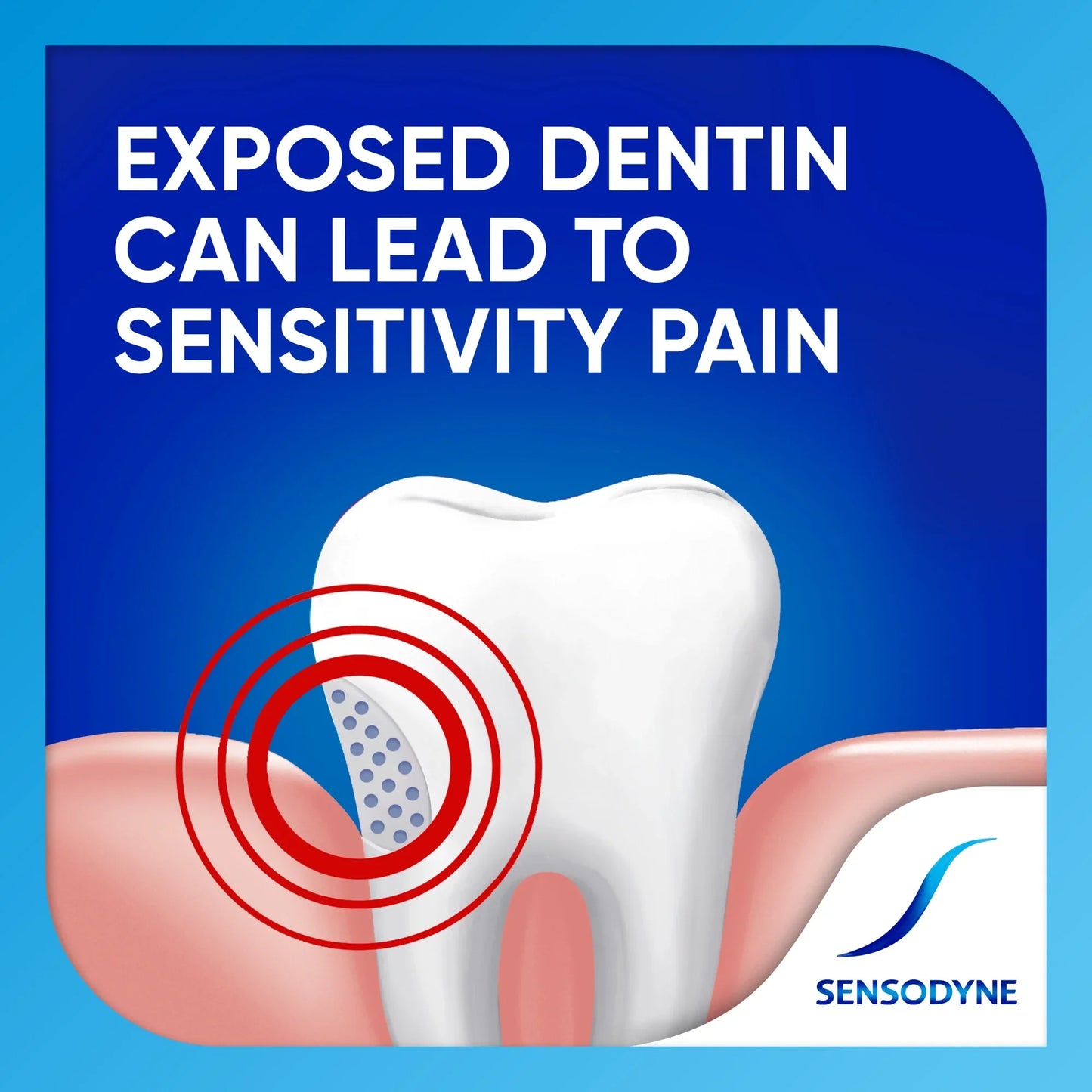Sensodyne Extra Whitening Sensitive Toothpaste, Mint, 4 Oz, 2 Pack, for Adults